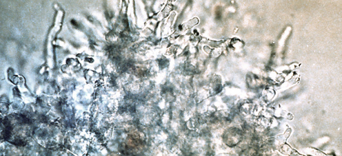 5 research aspergillus