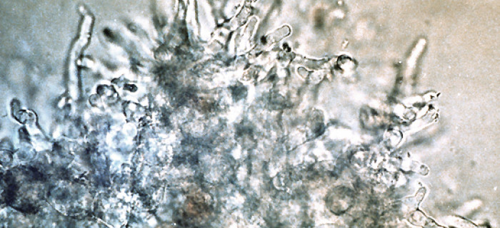 5 research aspergillus